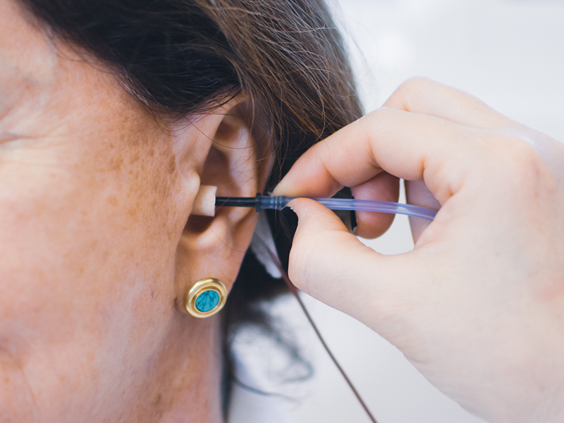 IAE Potencial Evocado Miogenico Vestibular Cervical VEMPc 1